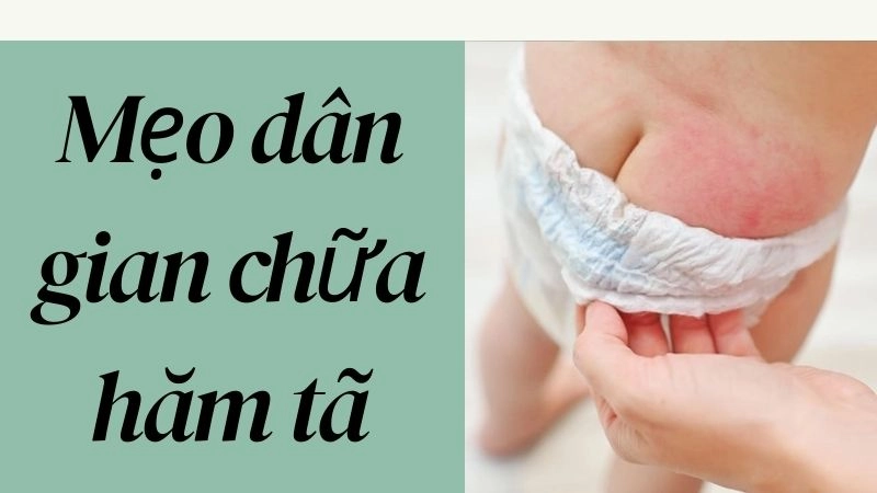  Mẹo dân gian chữa hăm tã hiệu quả cho cả mùa nóng lẫn lạnh 